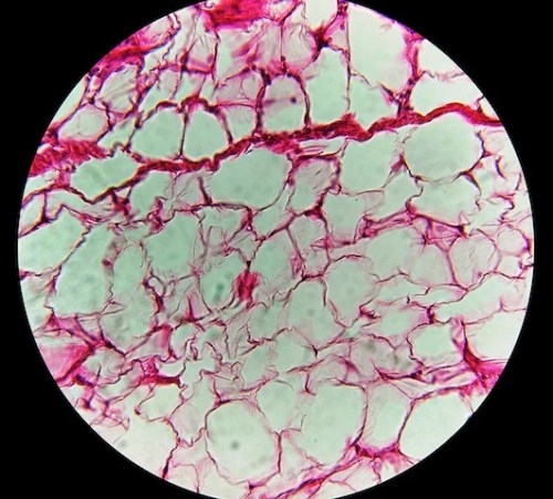 Adipose tissue